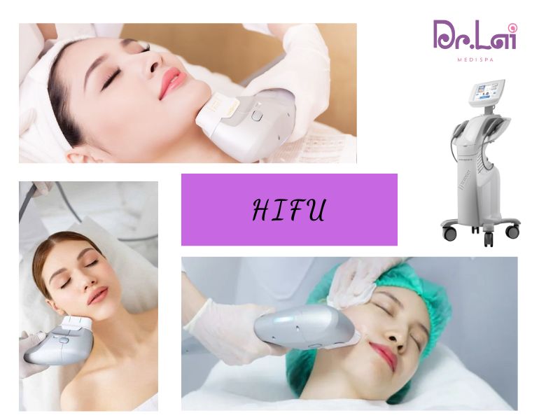 Công nghệ HIFU là gì? Đỉnh cao của sóng siêu âm hội tụ