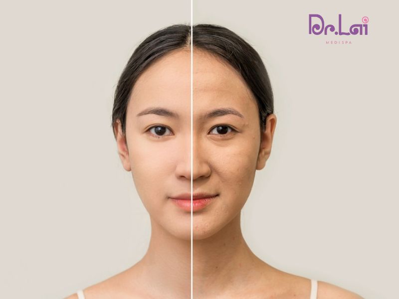 Những công dụng của HIFU trong việc trẻ hóa da toàn diện