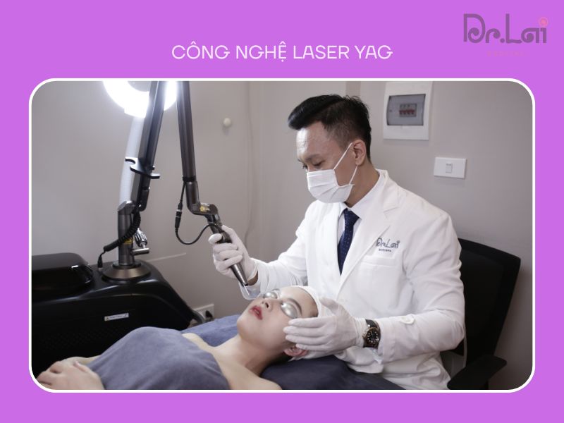 Trị thâm mụn bằng phương pháp laser YAG